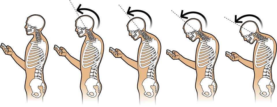 Illustration of smartphone head posture effects.